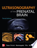 Ultrasonography of the Prenatal Brain  Third Edition