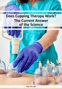 Does Cupping Therapy Work? The Current Answer of the Science