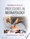 MacDonald s Atlas of Procedures in Neonatology Book