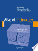 Atlas of Trichoscopy