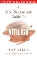 A No-Nonsense Guide To Vitiligo Pdf/ePub eBook