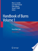 Handbook of Burns Volume 1 Acute Burn Care /