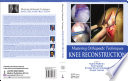 Mastering Orthopedic Techniques  Knee Reconstruction Book