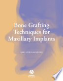Bone Grafting Techniques for Maxillary Implants Book