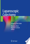 Laparoscopic Colectomy A Step by Step Guide /