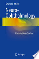 Neuro Ophthalmology Book