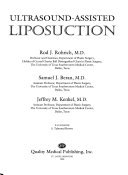 Ultrasound Assisted Liposuction