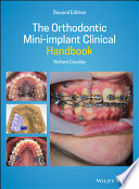 The Orthodontic Mini implant Clinical Handbook Book