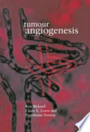 Tumour Angiogenesis