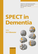 SPECT in Dementia