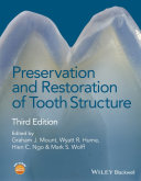 Preservation and Restoration of Tooth Structure