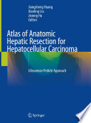 Atlas of Anatomic Hepatic Resection for Hepatocellular Carcinoma Book