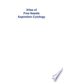 Atlas of Fine Needle Aspiration Cytology Book