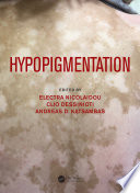 Hypopigmentation /
