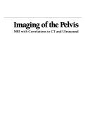 Imaging of the Pelvis