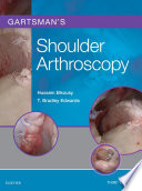 Gartsman s Shoulder Arthroscopy E Book