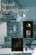 Spinal Meningiomas