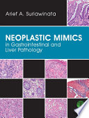 Neoplastic Mimics in Gastrointestinal and Liver Pathology Book