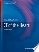 CT of the Heart Book