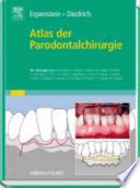 Atlas der Parodontalchirurgie