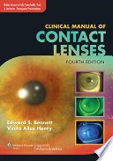 Clinical Manual of Contact Lenses Book