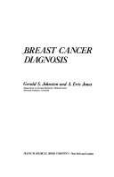 Breast Cancer Diagnosis