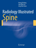 Read Pdf Radiology Illustrated: Spine