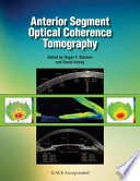 Anterior Segment Optical Coherence Tomography Book
