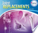 Joint Replacements