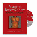 Aesthetic Breast Surgery: Concepts and Techniques