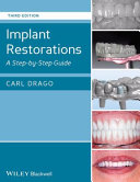 Implant Restorations Book