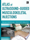 Atlas Of Ultrasound Guided Musculoskeletal Injections