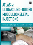 Atlas of Ultrasound-Guided Musculoskeletal Injections Pdf/ePub eBook