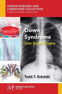 Down Syndrome Book