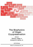 The Biophysics of Organ Cryopreservation