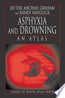 Asphyxia and Drowning Book