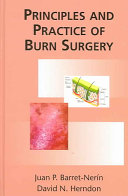 Principles and Practice of Burn Surgery Book