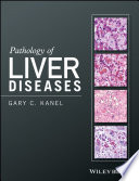 Pathology of Liver Diseases Book