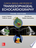 Clinical Manual and Review of Transesophageal Echocardiography, 3/e